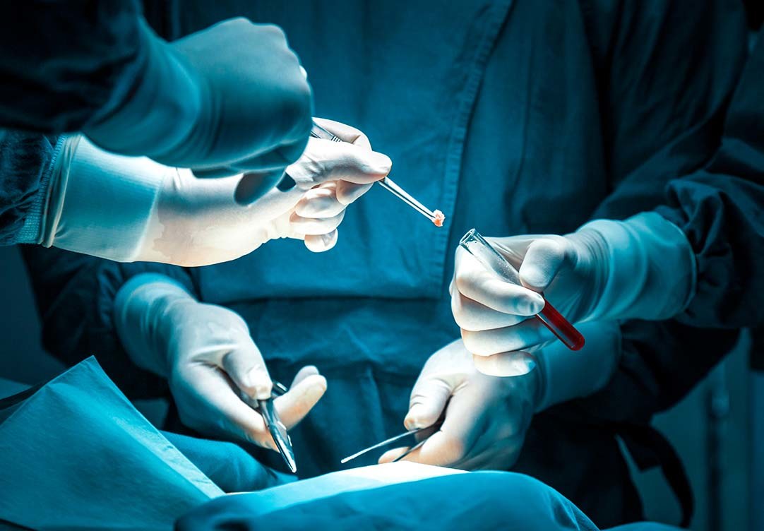 Procedimento de Cirurgia Oncológica